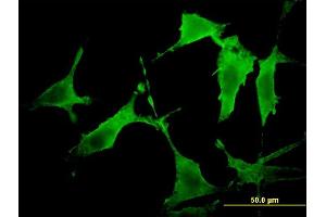 Immunofluorescence of monoclonal antibody to PAK3 on NIH/3T3 cell. (PAK3 antibody  (AA 1-90))