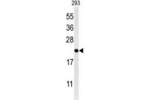 Western blot analysis of MRAP (arrow) in 293 cell line lysates (35ug/lane) using MRAP Antibody (N-term).