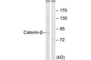 Western blot analysis of extracts from 293 cells, using Catenin-beta (Ab-489) Antibody. (beta Catenin antibody  (AA 455-504))