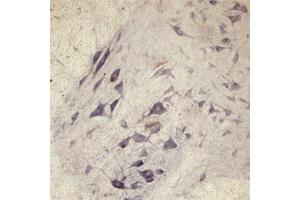 IHC on rat spinal cord using Rabbit antibody to Vesicle-trafficking protein SEC22b (SEC22B, SEC22L1,  ERS24): IgG (ABIN351370) at a concentration of 30 µg/ml. (SEC22B antibody  (AA 2-50))