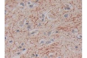Kallikrein 2 antibody  (AA 19-261)