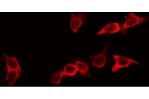 ABIN6266713 staining HeLa by IF/ICC. (Ephrin A2 antibody  (N-Term))