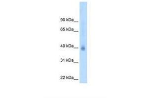 Image no. 2 for anti-Nuclear Receptor Subfamily 2, Group F, Member 2 (NR2F2) (N-Term) antibody (ABIN324526) (NR2F2 antibody  (N-Term))