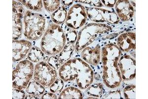 Immunohistochemistry (IHC) image for anti-Bruton Agammaglobulinemia tyrosine Kinase (BTK) antibody (ABIN1496971) (BTK antibody)