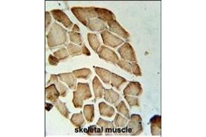 LDHD Antibody (N-term) (ABIN651920 and ABIN2840455) immunohistochemistry analysis in formalin fixed and paraffin embedded human skeletal muscle followed by peroxidase conjugation of the secondary antibody and DAB staining.
