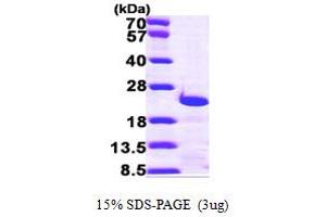 SDS-PAGE (SDS) image for Centrin, EF-Hand Protein, 3 (CETN3) (AA 1-167) protein (His tag) (ABIN667815)