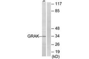 Western blot analysis of extracts from Jurkat cells, using GRAK Antibody.