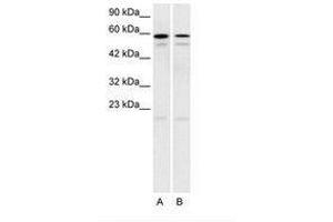 Image no. 1 for anti-5-Hydroxytryptamine (serotonin) Receptor 2C (HTR2C) (AA 28-77) antibody (ABIN202566) (HTR2C antibody  (AA 28-77))