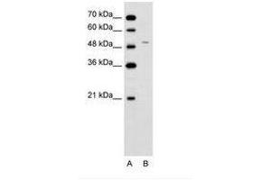 Image no. 2 for anti-Ferrochelatase (FECH) (AA 51-100) antibody (ABIN6736623) (FECH antibody  (AA 51-100))