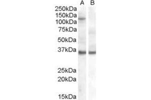 HEK293 overexpressing EIF2C1 and probed with ABIN185581 (non-transfected HEK293 in lane B). (AGO1 antibody  (Internal Region))