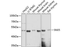 Western blot analysis of extracts of various cell lines, using SNX5 antibody (ABIN6128730, ABIN6148253, ABIN6148254 and ABIN6217052) at 1:3000 dilution.