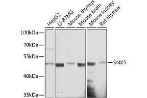 Western blot analysis of extracts of various cell lines, using SNX5 antibody (ABIN6128730, ABIN6148253, ABIN6148254 and ABIN6217052) at 1:3000 dilution. (SNX5 antibody  (AA 145-404))