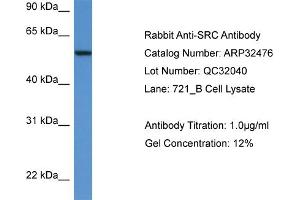 WB Suggested Anti-SRC Antibody Titration: 0. (Src antibody  (N-Term))