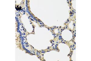Immunohistochemistry of paraffin-embedded rat lung using IL36G antibody (ABIN5974550) at dilution of 1/100 (40x lens). (IL1F9 antibody)
