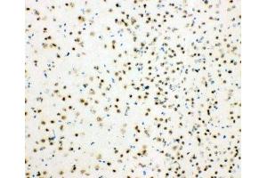 IHC-F testing of mouse brain tissue (HDAC3 antibody  (AA 411-428))