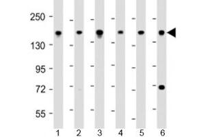 Western blot testing of human 1) 293T/17, 2) DU-145, 3) LNCaP, 4) Raji, 5) U-2OS and 6) HeLa cell lysate with PDS5B antibody at 1:2000.