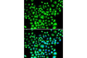 Immunofluorescence analysis of U2OS cells using BCAP31 antibody (ABIN5974244). (BCAP31 antibody)