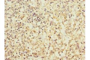 Immunohistochemistry of paraffin-embedded human spleen tissue using ABIN7171372 at dilution of 1:100 (CD1c antibody  (AA 18-300))