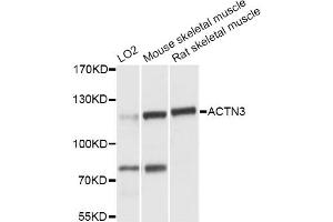 Western blot analysis of extracts of various cell lines, using ACTN3 antibody (ABIN6290057) at 1:3000 dilution.