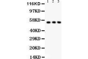 Anti- SLC2A2 Picoband antibody, Western blotting All lanes: Anti SLC2A2  at 0. (SLC2A2 antibody  (C-Term))