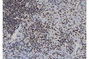 ABIN6278106 at 1/100 staining Human spleen tissue by IHC-P. (RBBP7 antibody  (N-Term))