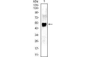 Western blot analysis using KRT13 mouse mAb against A431 (1) cell lysate.