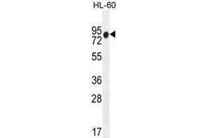 ZNF665 Antibody (N-term) western blot analysis in HL-60 cell line lysates (35 µg/lane). (ZNF665 antibody  (N-Term))