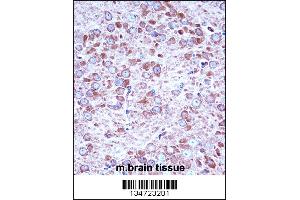 Mouse Aak1 Antibody immunohistochemistry analysis in formalin fixed and paraffin embedded mouse brain tissue followed by peroxidase conjugation of the secondary antibody and DAB staining.