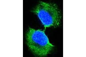 Confocal immunofluorescence analysis of PC-3 cells using GSTP1 antibody (green). (GSTP1 antibody)