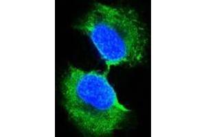 Confocal immunofluorescence analysis of PC-3 cells using GSTP1 antibody (green). (GSTP1 antibody)