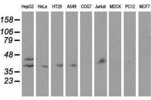 Western blot analysis of extracts (35 µg) from 9 different cell lines by using anti-HP monoclonal antibody. (Haptoglobin antibody)
