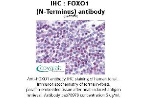 Image no. 2 for anti-Forkhead Box O1 (FOXO1) (N-Term) antibody (ABIN1734423)