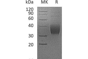 Western Blotting (WB) image for Programmed Cell Death 1 Ligand 2 (PDCD1LG2) protein (His tag) (ABIN7320958)