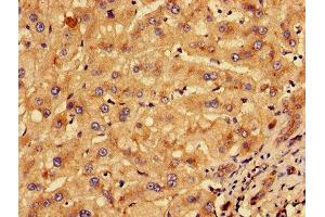 Immunohistochemistry of paraffin-embedded human liver tissue using ABIN7157273 at dilution of 1:100 (KLHL2 antibody  (AA 1-155))