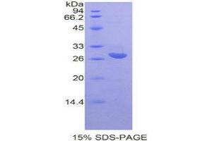 SDS-PAGE (SDS) image for Interleukin 22 Receptor, alpha 2 (IL22RA2) (AA 30-228) protein (His tag) (ABIN2125485)