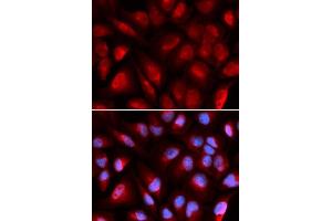 Immunofluorescence analysis of U2OS cells using MCM5 antibody.