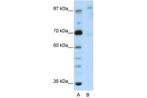 GLIS3 antibody (20R-1239) used at 0. (GLIS3 antibody  (N-Term))