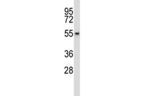 WEE2 antibody  (AA 364-393)