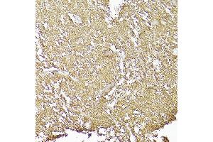 Immunohistochemistry of paraffin-embedded human brain using CD90/Thy1 Rabbit mAb (ABIN6129735, ABIN6148554, ABIN6148555 and ABIN7101405) at dilution of 1:100 (40x lens). (CD90 antibody)