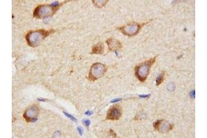 IHC-P: PPID antibody testing of rat brain tissue