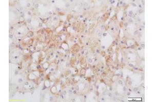 Formalin-fixed and paraffin embedded rat kidney labeled with Rabbit Anti GNMT Polyclonal Antibody, Unconjugated (ABIN739680) at 1:200 followed by conjugation to the secondary antibody and DAB staining