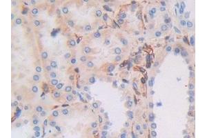 Detection of MHCC in Human Kidney Tissue using Polyclonal Antibody to Major Histocompatibility Complex Class I C (MHCC) (MHCC (AA 48-305) antibody)