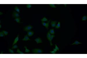 Detection of APAF1 in Human Hela cell using Polyclonal Antibody to Apoptotic Peptidase Activating Factor 1 (APAF1) (APAF1 antibody  (AA 31-350))