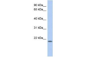 CHAC2 antibody used at 1 ug/ml to detect target protein. (CHAC2 antibody)