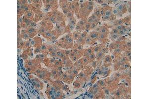 IHC-P analysis of liver tissue, with DAB staining. (TOLLIP antibody  (AA 28-261))