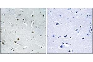 Immunohistochemistry analysis of paraffin-embedded human brain, using DDX24 Antibody.
