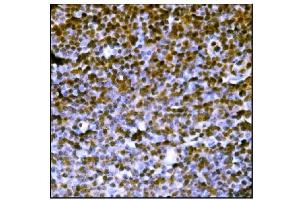 IHC analysis of PML Protein/Pml using anti-PML Protein/Pml antibody (ABIN7599678).
