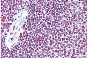 Human Spleen: Formalin-Fixed, Paraffin-Embedded (FFPE) (p300 antibody  (AA 731-831))