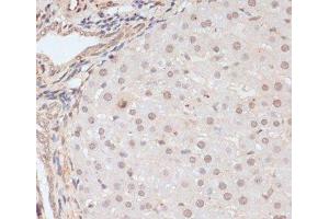 Immunohistochemistry of paraffin-embedded Rat liver using Phospho-BRCA1(S1423) Polyclonal Antibody at dilution of 1:100 (40x lens). (BRCA1 antibody  (pSer1423))