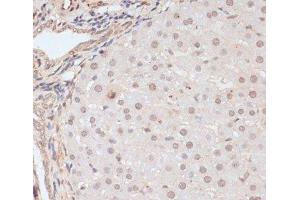 Immunohistochemistry of paraffin-embedded Rat liver using Phospho-BRCA1(S1423) Polyclonal Antibody at dilution of 1:100 (40x lens).